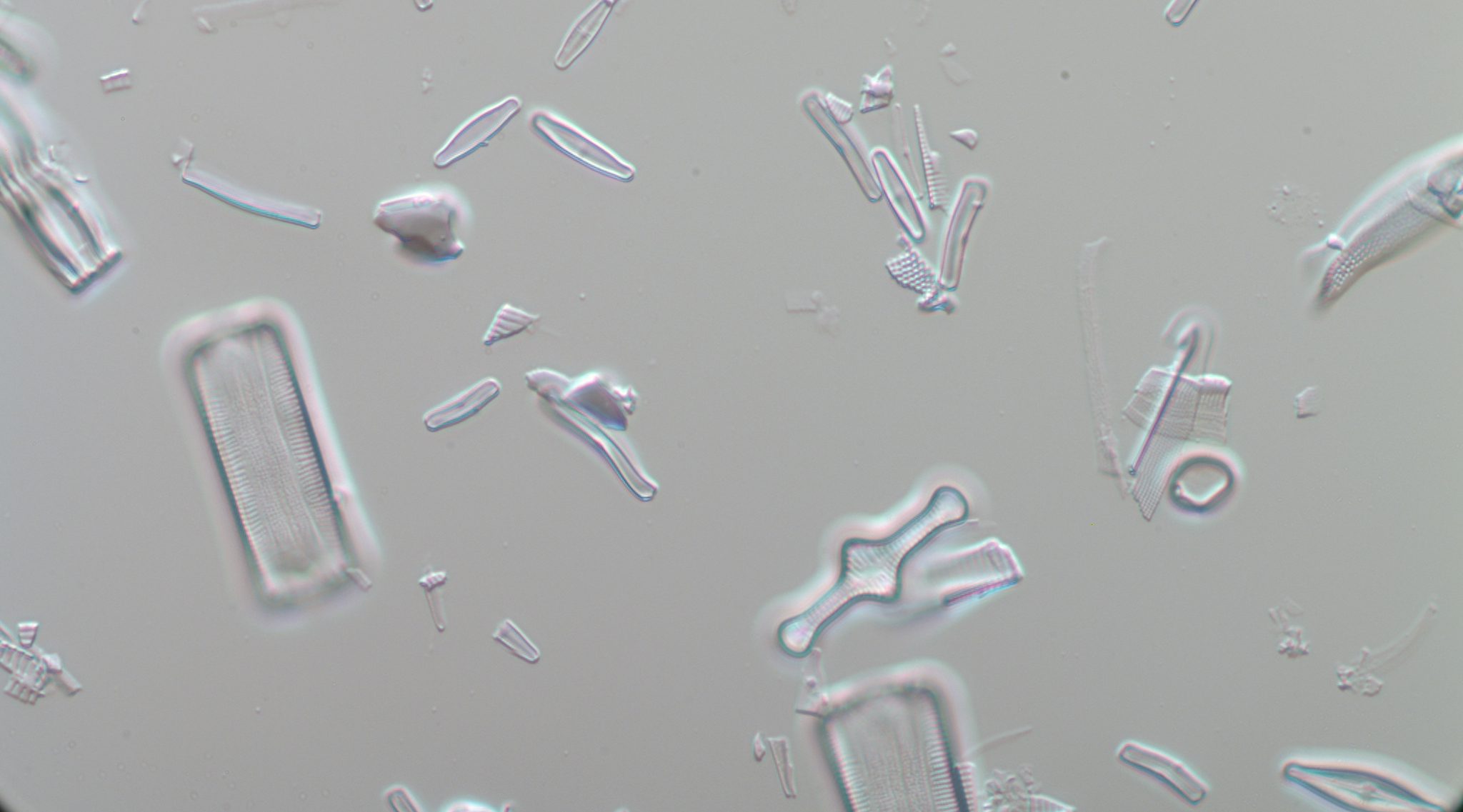Kiselalgen Achnanthidium minutissimum. Mikroskoplbild.