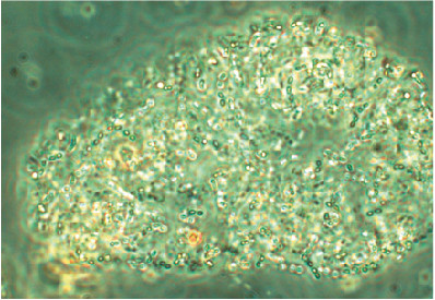 Den kolonibildande cyanobakterien Cyanodictyon sp. som tillhör gruppen Chroococcales. Foto: Helena Höglande