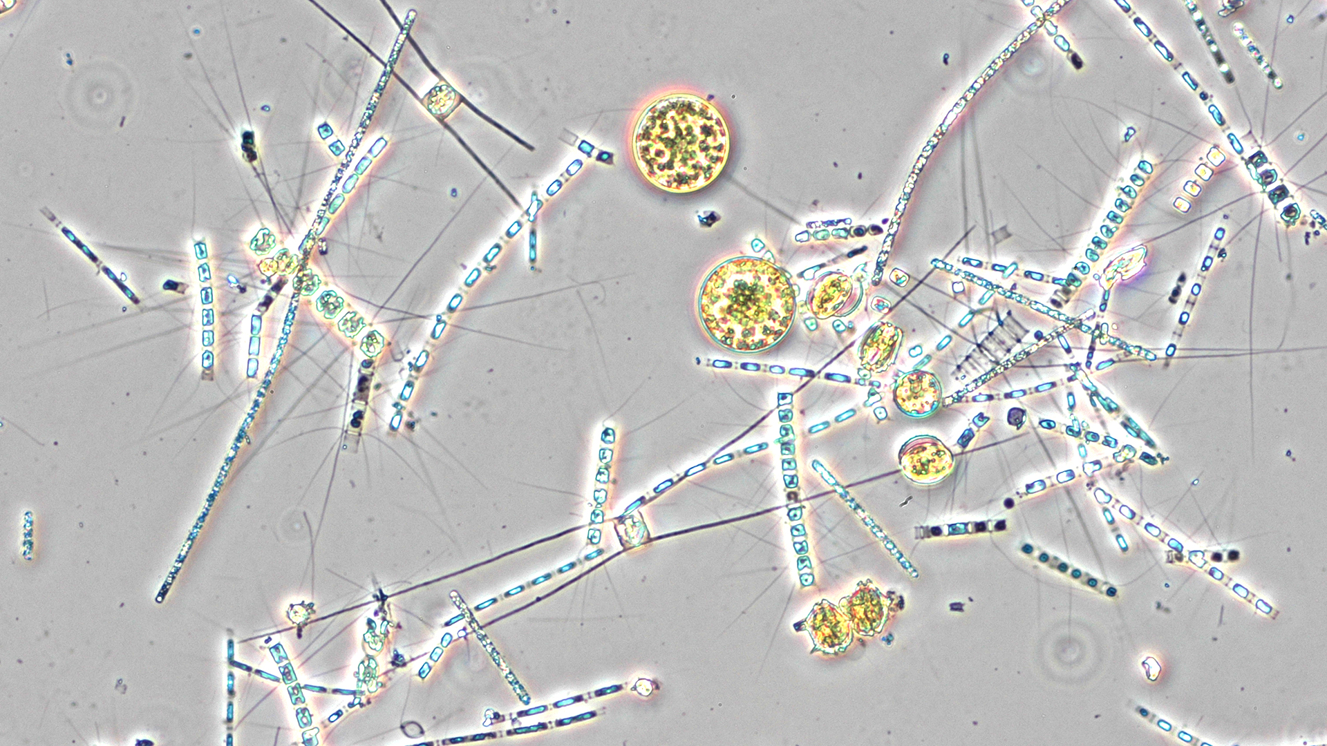 växtplankton i mikroskop